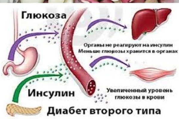 Как восстановить страницу на кракене